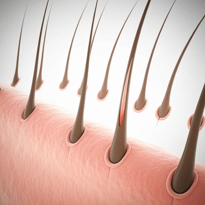 Microscopic view of hair follicles, some healthy and some showing signs of miniaturization, illustrating genetic and hormonal hair loss factors, clean image